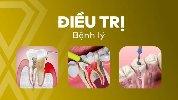 Điều trị bệnh lý