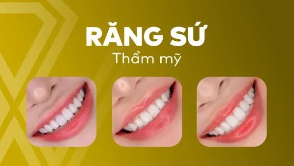 Răng sứ & Thẩm mỹ