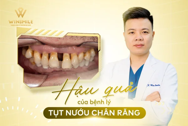 Gum & periodontal disease