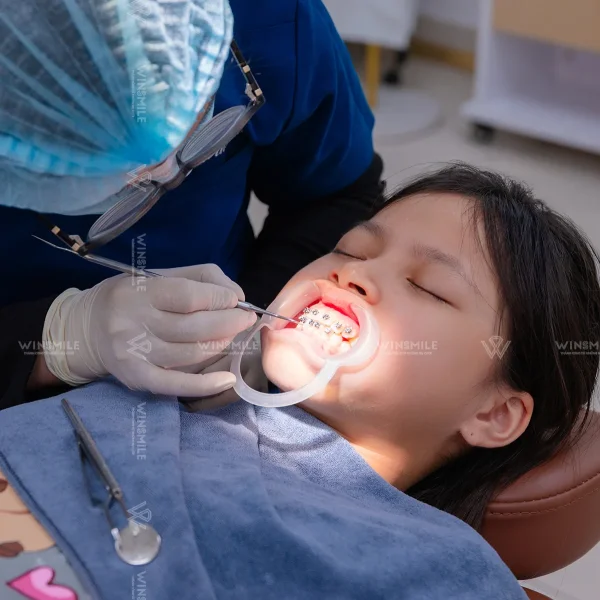 Early Orthodontic Treatment